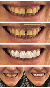 Planificacion-estetica-odontologica-Clinica-garcia-vega-dentista
